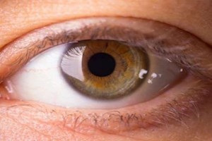 Ăn gì để đôi mắt khỏe mạnh hơn